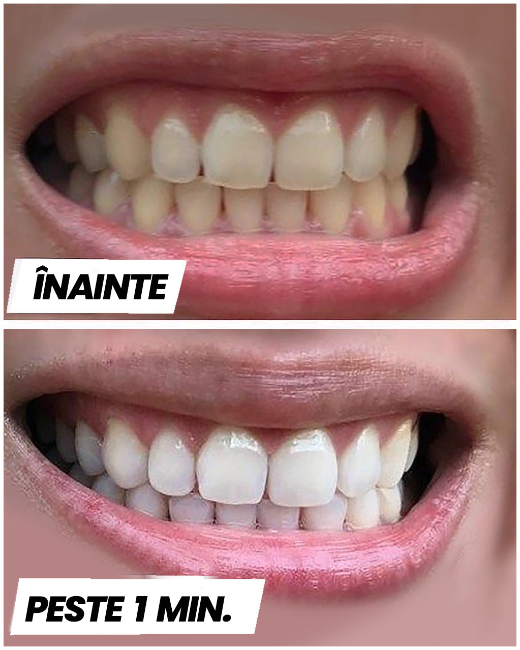 Tooth Whitening Paste™